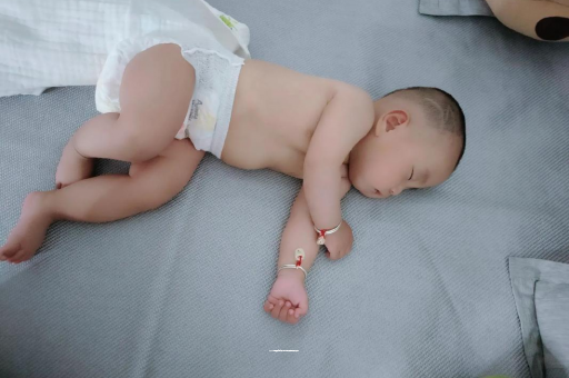 山东六个月宝宝眼睛散光